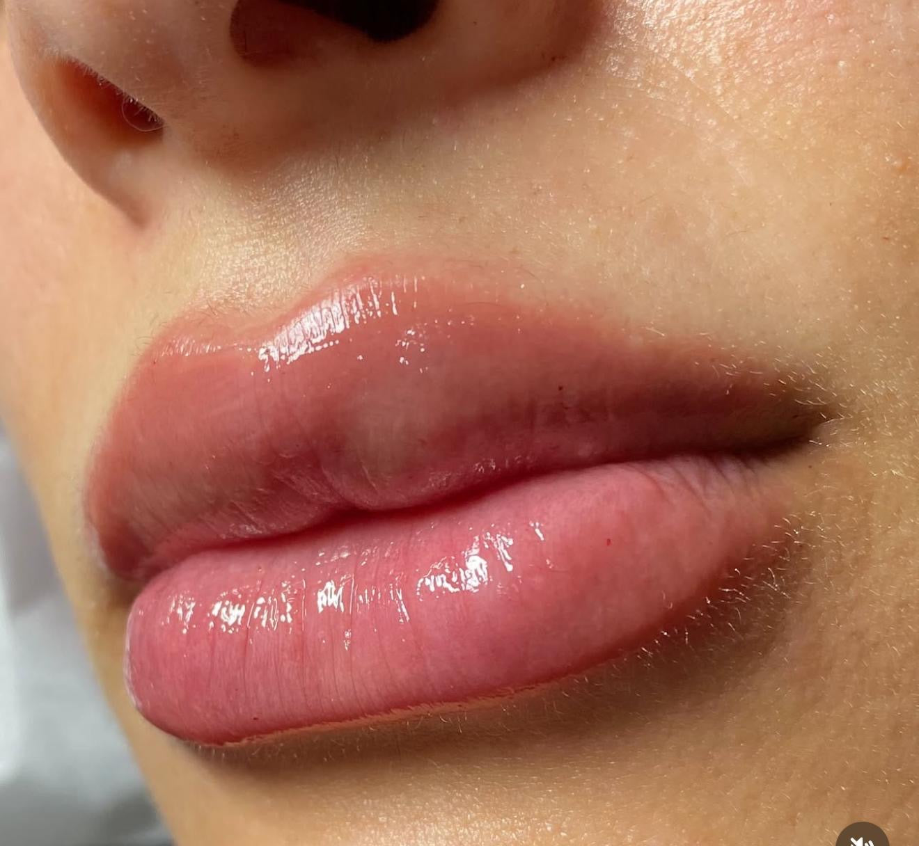 Lip Micropigmentation