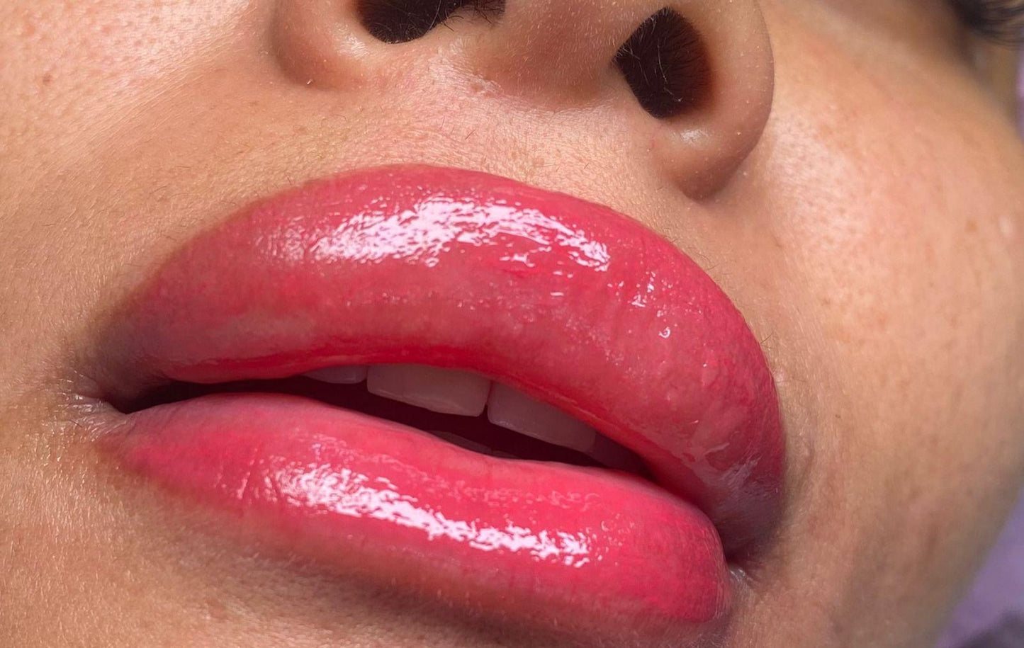 Lip Micropigmentation